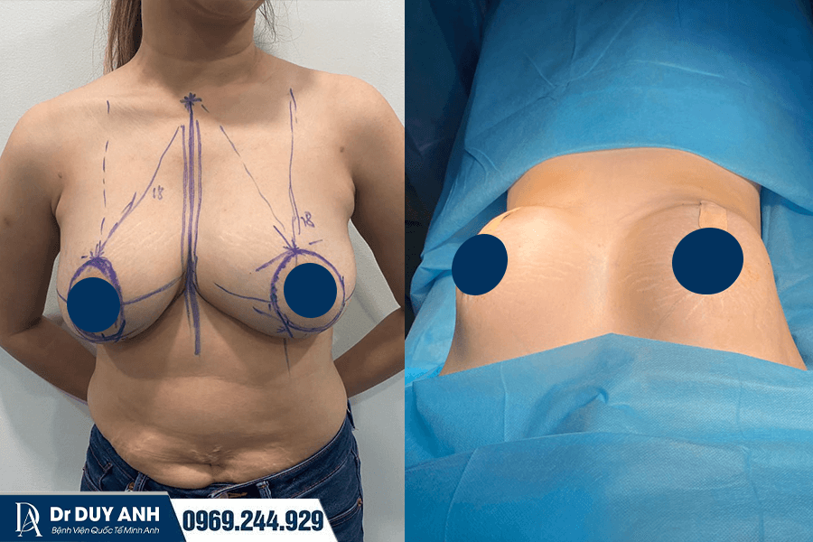 Top 3 Địa Chỉ Treo Sa Trễ An Toàn, Uy Tín, Được Cấp Phép Tại TP.HCM 2026