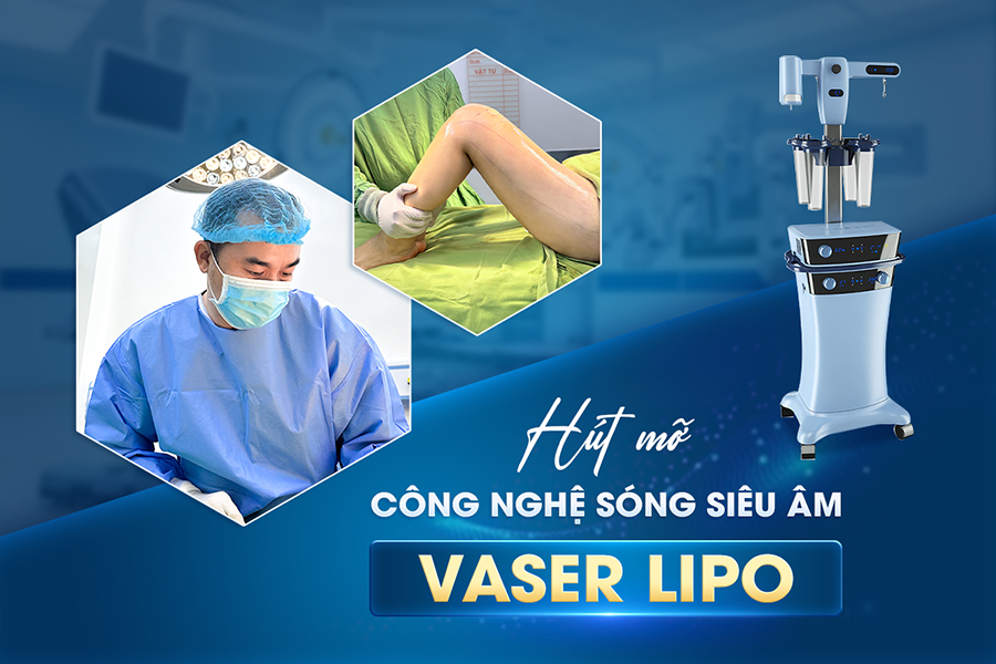 Hút Mỡ Vaser–Lipo Là Gì? Có An Toàn Không? Chi Phí Bao Nhiêu 2025?